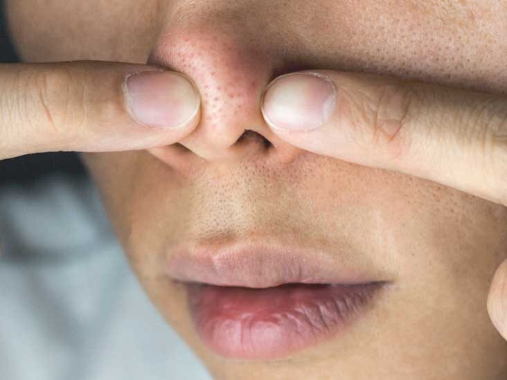 hot-to-easily-get-rid-of-bump-on-the-nose-top-3-tips